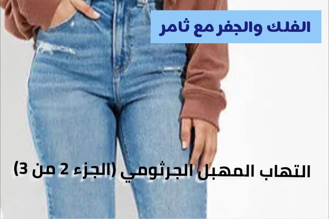 التهاب المهبل الجرثومي (الجزء 3 من 3)